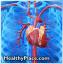 Pacientų, turinčių didelę širdies aritmijos riziką, nustatymas ir gydymas modifikuotos ECT metu
