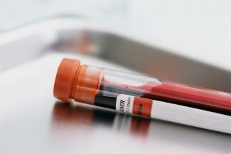 Neseniai buvo atliktas kraujo tyrimas, siekiant numatyti padidėjusią savižudybių riziką, tačiau ar tikrai galime numatyti savižudybės riziką atlikdami paprastą kraujo tyrimą?